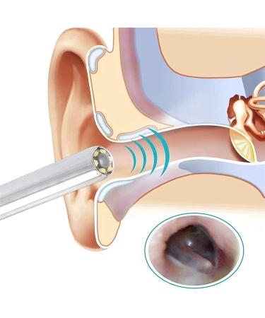 XIXIDIAN Ear Wax Removal Tool Wireless Ear Endoscope Cleaner with Camera 5.5 mm Otoscope Ear Cleaner with LED Lights for Adults Kids - Buy Online on GoSupps.com
