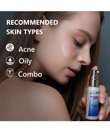Professional Acne Serum - Non-Sticky Face Moisturizer for Acne Scars Control | No Parabens & Sulfates | 1.1 Oz - Buy Online on GoSupps.com