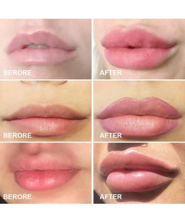 Lip Plumper Device | Manual Lip Enhancer for Natural Fuller Lips | Self-Suction Tool for Women | Perfect Girlfriend Gift - Buy Online on GoSupps.com
