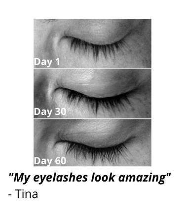 Vera Botanics Lash & Brow Booster Serum for Longer Fuller Eyelashes & Eyebrows - Bestselling Natural Enhancer for Growth & Regrowth - Buy Online on GoSupps.com
