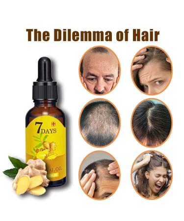 Ginger Germinal Hair Growth Serum - 1oz, 7 Days Accelerate Growth, Thickening Formula - 20ML (3pcs) - Buy Online on GoSupps.com