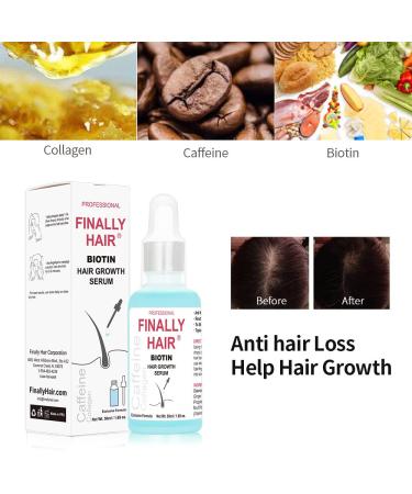 Women's Hair Loss Treatment Serum with Biotin, Collagen, and Caffeine - Promotes Hair Growth and Supports Regrowth - Buy Online on GoSupps.com