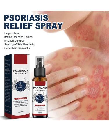 LMDO Psoriasis Relief Spray - Eczema Therapy for Itching Relief & Skin Repair - Buy Online on GoSupps.com