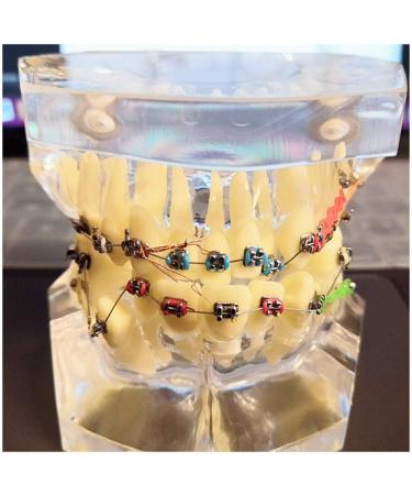 Dytah dental painting painting orthodontic treatment teeth model with brackets added buccal tube dental treatment maloklion study for lessons