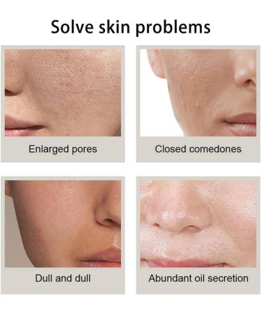 GNHG 30ml Niacinamide facial moisturizing essence for vulgar aging and wrinkles for softening and moisturizing skin also suitable for all skin types - Buy Online on GoSupps.com