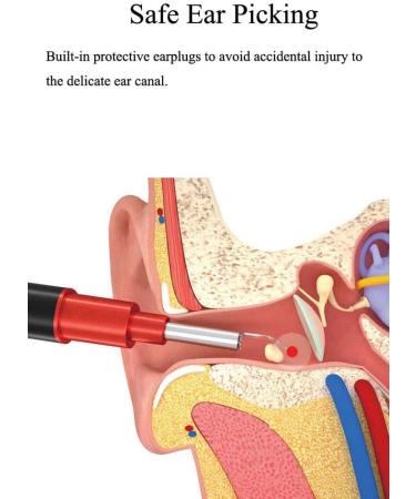 VRfamily Smart HD Visual Ear Cleaning Spoon Wireless WiFi Removal Earwax Cerumen Tool - Buy Online on GoSupps.com