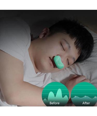 PP Rechargeable Snoring Device - Ergonomic Snore Solution for Men and Women - Home and Travel Friendly - Buy Online on GoSupps.com