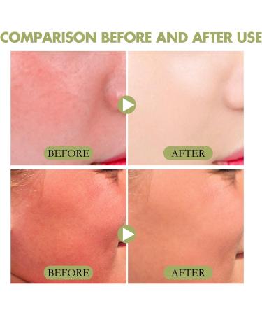 Beauty of Josaon Matte Sun Stick & SPF50 Organic Sunscreen | Glow Deep Serum (5PCS) - Buy Online on GoSupps.com