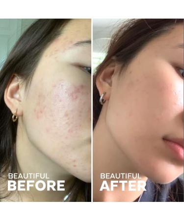 Three Ships Radiance Grape Stem Cell + Squalane Day Cream | Vegan Facial Moisturizer for All Skin Types | Hydrates & Balances Skin | 50g - Buy Online on GoSupps.com