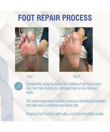 Basix Skin Defense Foot Food - Repair Cream with 5% Urea & Peppermint Oil for Dry Feet & Cracked Heels - Nourish & Revitalize Tired Feet - Buy Online on GoSupps.com