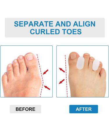 Sumifun Silicone Toe Separator - 8 Pairs Gel Bunion Corrector Pads for Overlapping & Crooked Toes - Reusable Hammer Toe Spacer for Men & Women - Buy Online on GoSupps.com
