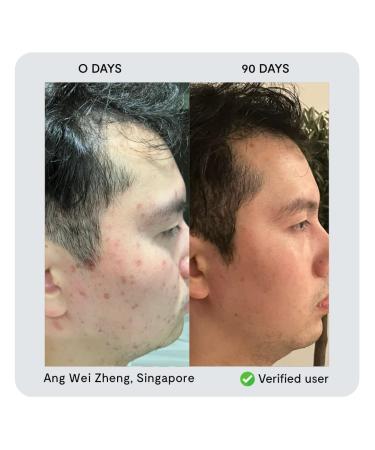 nor sken Reverse-aging Natural Vegan Facial Cream to Increase Skin Elasticity and Collagen Decrease Wrinkles and Redness - Buy Online on GoSupps.com