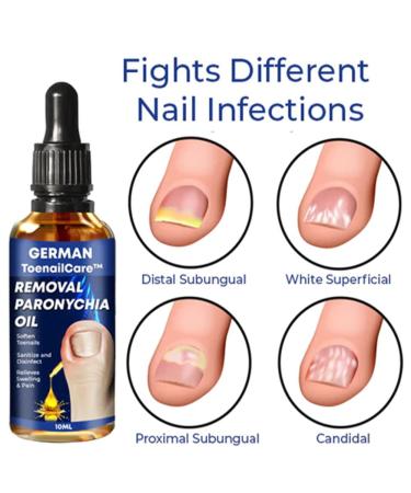 German ToenailPlus Anti Paronychia Relief Oil - Repair Damaged Nails (2 Pcs) - Buy Online on GoSupps.com