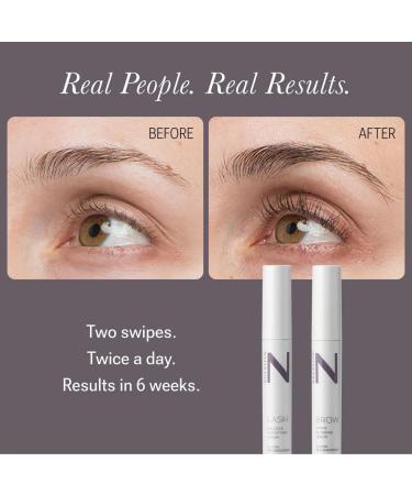 NULASTIN Solution Serum System - Lash Serum (0.1 Fl Oz) Scalp Treatment (1.7 Oz) + Brow Serum (0.1 Fl Oz) - Travel Gift Set for Fuller Lashes Thicker Hair & Defined Brows (3 Count) - Buy Online on GoSupps.com