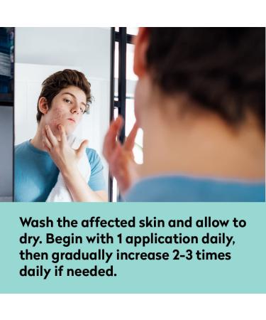 All Acne Treatment - Face and Body - Spot and Full Coverage - Gel Formula - 9 Skin Boosters - Buy Online on GoSupps.com