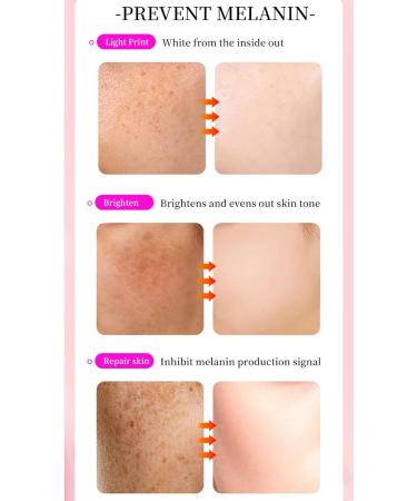  Generisch Arbutin 7% + Tranexamic Acid 4% Cream 70 000 ppm Arbutin 40 000 ppm TXA Niacinamide improves your genetic structure - Buy Online on GoSupps.com