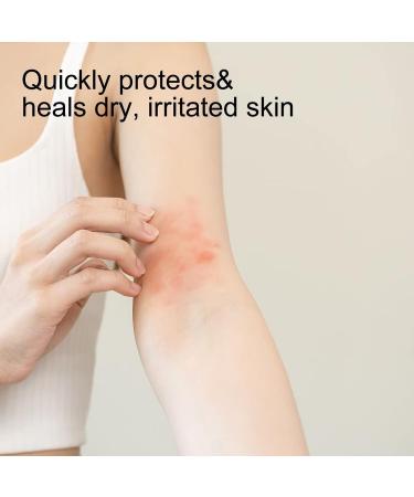 Wanski Natural Eczema Cream for Fast Relief | Herbal Ingredients for Sensitive Skin Types - Buy Online on GoSupps.com