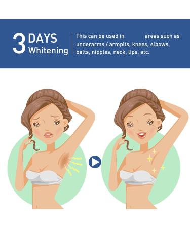 Whitening Cream for Sensitive Areas Skin Lightening Cream Brightening Cream for Intimate Areas Removes Brown Spots with Vitamin C for Armpits Knees (1) - Buy Online on GoSupps.com