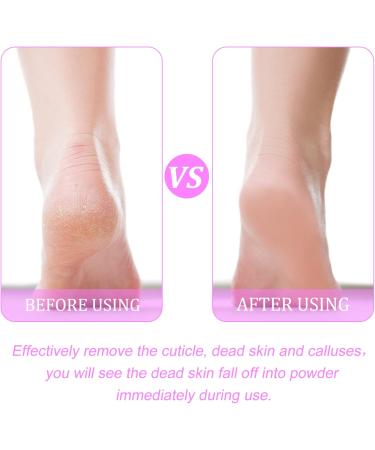 Housoutil Glass Foot Rub Foot Exfoliator Tool Foot Care Scrubber Shower Foot Scrubber Foot Remover Pedicure Foot File Foot Pedicure Tool Fingernail Clipper Scraper Set Pink Feet Abs - Buy Online on GoSupps.com