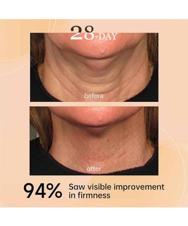 SHENGZE 2pc AH8 Firming Neck CreamTighten and Lift Neck CreamNeckcream for Lifting and Nourishing and MoisturizingDual Roller MassageContain HexapeptideReduce Wrinkles Fine Lines - Buy Online on GoSupps.com