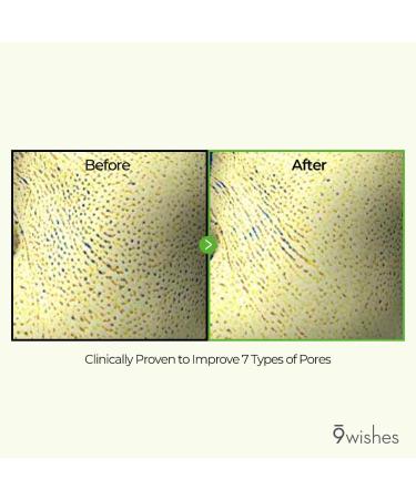 9 Wishes Pine Treatment Cream 1.7 fl. oz | Tightening & Pore Minimizing Cream with Pine Needle Extract & Niacinamide | Korean Skincare for Dead Skin Cell Improvement & Soothing Benefits - Buy Online on GoSupps.com