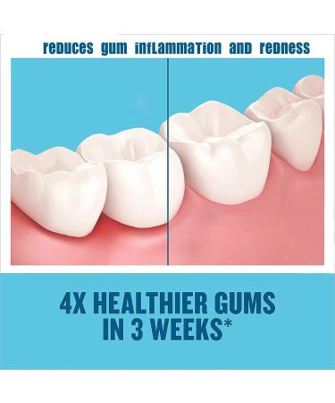 2Pcs Whitening Mouthwash Mousse for Calculus Removal & Fresh Breath - Buy Online on GoSupps.com