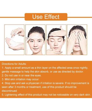  Gyiocill Anti-blemish cream freckle removal cream for face and body skincare product improves skin tone and quality suitable for all skin types - Buy Online on GoSupps.com