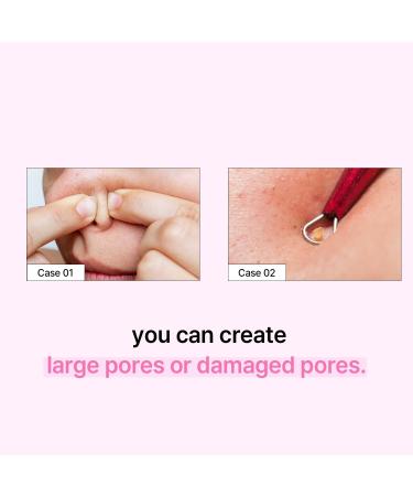 ILSO Super Melting Sebum Softener - Pore Cleansing Solution for Blackheads & Sebum | Korean Skincare | Esther Bunny Limited Edition (Pink - Buy Online on GoSupps.com