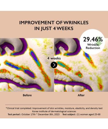 HARUHARU wonder Centella Phyto & 5 Peptide Concentrate Cream Daily & Night Cream Nourishing Wrinkles improvement for all skin types Vegan Cruelty-Free Korean Skincare 1.01 fl. Oz - Buy Online on GoSupps.com