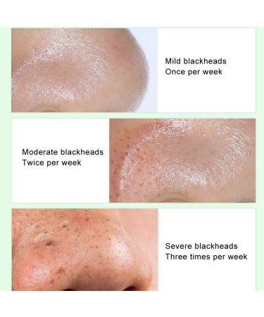 Shop Crazy Sale: 17ml Pore Cleaning Liquid & 100 Blackhead Removing Strips Effective Face Cleaning Tools - Buy Online on GoSupps.com