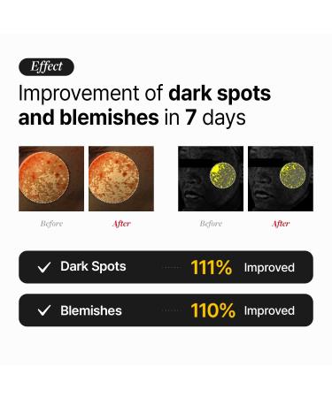 MEDITHERAPY VITA REAL Shot Clear Patch - Dark Spot & Acne Care Hydrocolloid Patch with Pure Vitamin C for Brightening | Korean Skincare (6EA - Buy Online on GoSupps.com