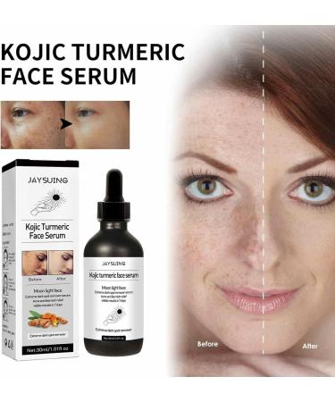  Hongjingda Turmeric - Liquid Dark Spot Removal | 1.01 FL oz Rejuvenating Skin Care for Women Moisturizes Dull and Dry Skin - Buy Online on GoSupps.com