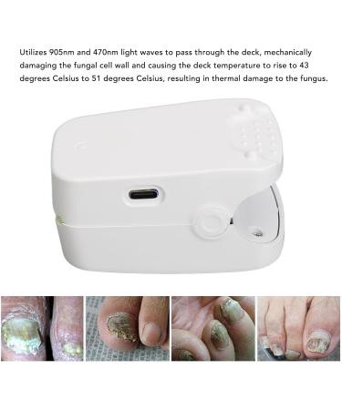 Horoper Nail Fungus Remover Device | Effective Treatment Kit for All Ages - Fast International Shipping - Buy Online on GoSupps.com