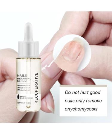 DUBUSH 7 day nail growth strengthening serum nail cuticle oil strengthener natural toenail treatment oil stronger nails in 1 week nail strengthening treatment treatment - Buy Online on GoSupps.com