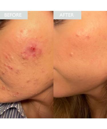 SKINICIAN Advanced Calming Serum for Sensitive Skin - Calming Anti-Ageing Serum to Reduce Breakouts - Soothes Irritated Skin - Reduces Redness - Vegan & Cruelty Free Skincare (50ml) - Buy Online on GoSupps.com