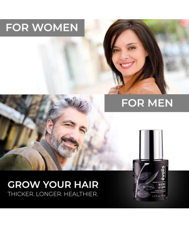 volis REVERSE Activator Hair Growth Treatment - Keratin Formula for Thinning Hair - Accelerates Growth, Reduces Hair Fall - Scalp Treatment for Hair Regrowth (1.7 fl oz) - Buy Online on GoSupps.com