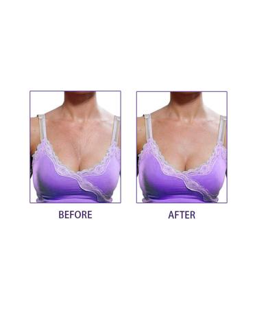 8-Part Reusable Silicone Anti-Fold Pad Set - Wrinkle Prevention & Elimination for Cleavage Chest and Eye Folds - Buy Online on GoSupps.com