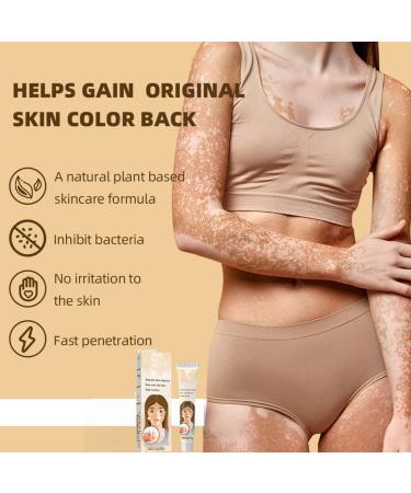 OIXYEY OIXEY 1 piece whitening cream natural plant extracts gently and effectively reduces white spots improves pigmentation suitable for all skin types 20 GA - Buy Online on GoSupps.com