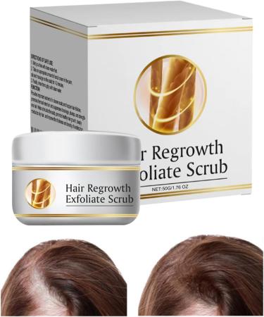Shampoing nettoyant pour cuir chevelu 50 g de solutions pour enlever l'accumulation de racines soins capillaires usage quotidien d tails pour adultes femmes hommes guide de routine d' t pour - Buy Online on GoSupps.com