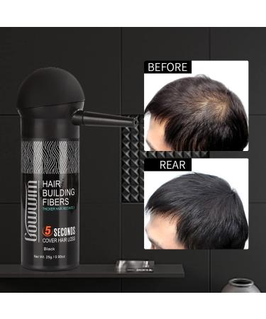 Gowwim Hair Thickening Fibers 2-in-1 Kit Set - Keratin Building Fibers & Spray Applicator - Instantly Cover Sparse Hair - Black - Buy Online on GoSupps.com