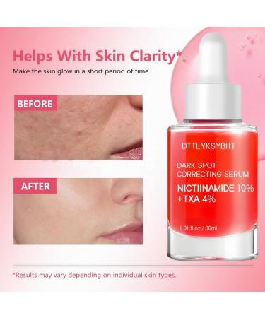 Niacinamide 10% TXA Serum - Brightening & Clarifying Facial Serum with Tranexamic Acid 4% Arbutin 2% Hyaluronic Acid - for Dark Spots Hyperpigmentation Melasma & Radiant Glass Skin - 30ml - Buy Online on GoSupps.com
