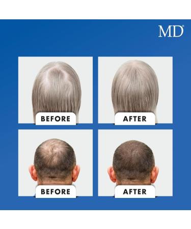 MD Nutri Hair Growth Support Supplement with Biotin 30 Capsules Nourish from Within for Healthier-Looking Hair - Buy Online on GoSupps.com