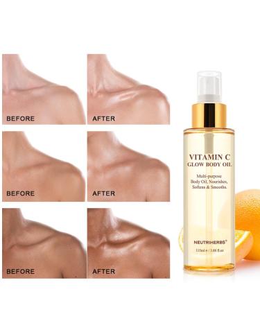 Neutriherbs Rosehip Oil for Dry Skin - Hydrating Moisturizer & Brightening Body Massage Oil - 115ml All Skin Types - Buy Online on GoSupps.com