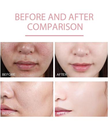 KOAHDE Peach Essence 70% Niacinamide Serum Brightening Hydrating Face Serum Daily Beauty Face Serum Peach Niacin Serum Anti-Aging Face Serum with Peach Essence Brightening and Hydrating Skincare 1PC - Buy Online on GoSupps.com