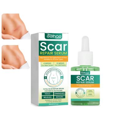 ScarRevita Advanced Repair Serum Scarrevita Repair Serum Scar Removal Spray Scar Remove Advanced Scar Repair Serum Suitable for All Skin Types (1PCS)