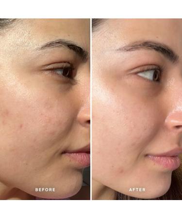 Alpha-H Liquid Gold and Midnight Reboot Serum Bundle - Buy Online on GoSupps.com