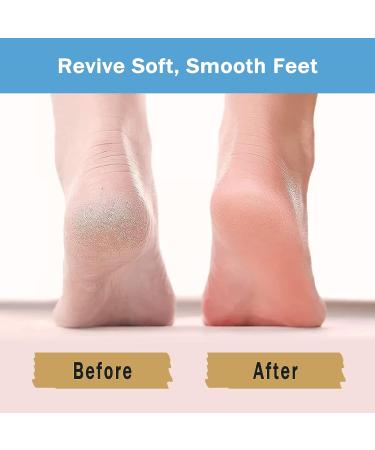 Moisturizing Gel Socks for Dry Cracked Heels - Foot Spa Treatment for Softening and Hydrating Heels (1 Pair) - Buy Online on GoSupps.com