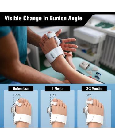 Tech Love Bunion Corrector Kit - Bunion Relief for Day & Night - Adjustable Splint, Toe Separators, Exercise Band included - Buy Online on GoSupps.com