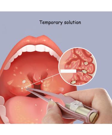 Tonsil Stone Removal Kit - Professional Stainless Steel Tools for Easy Oral Care & Relief - Buy Online on GoSupps.com