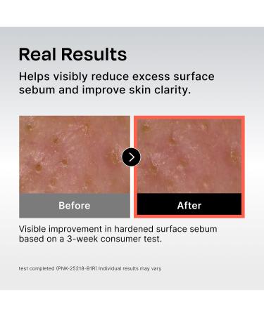 Celladix Sebum Rebalancing Rx 131 Ampoule | Pore Clearing Serum | Tighten Enlarged Pores | Repair Skin Barrier | Rapid Soothing for Daily Use | Oily & Combination Skin| 1.01 Fl Oz 1.01 Fl Oz (Pack of 1) - Buy Online on GoSupps.com